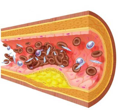 Colesterol